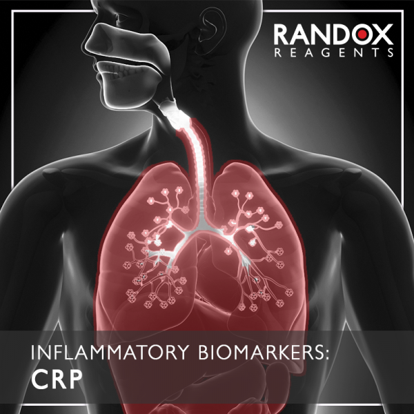 Inflammatory Biomarker Series Crp Randox Laboratories