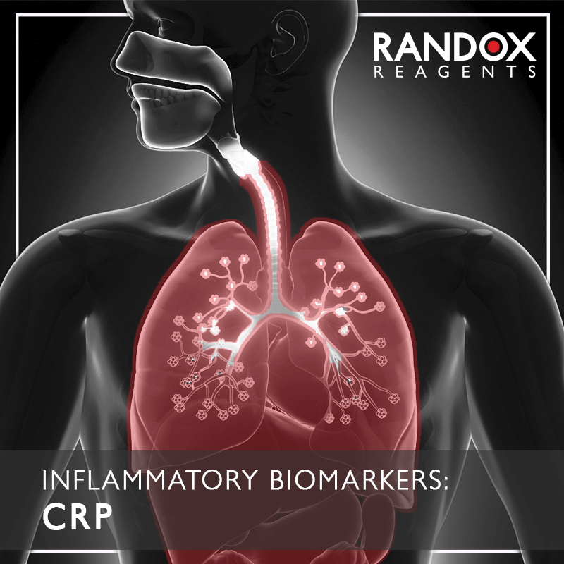 Inflammatory Biomarker: CRP