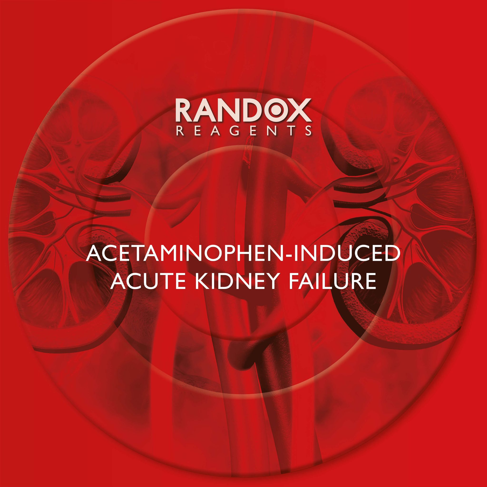 acetaminophen-induced-acute-kidney-failure-randox-laboratories