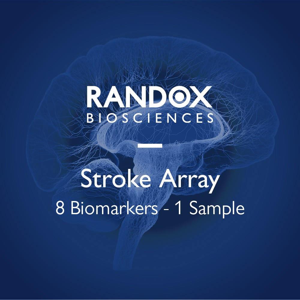 Stroke Array from Randox Biosciences