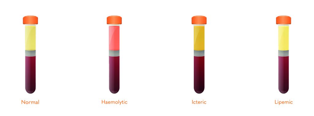 Serum Indices Vials