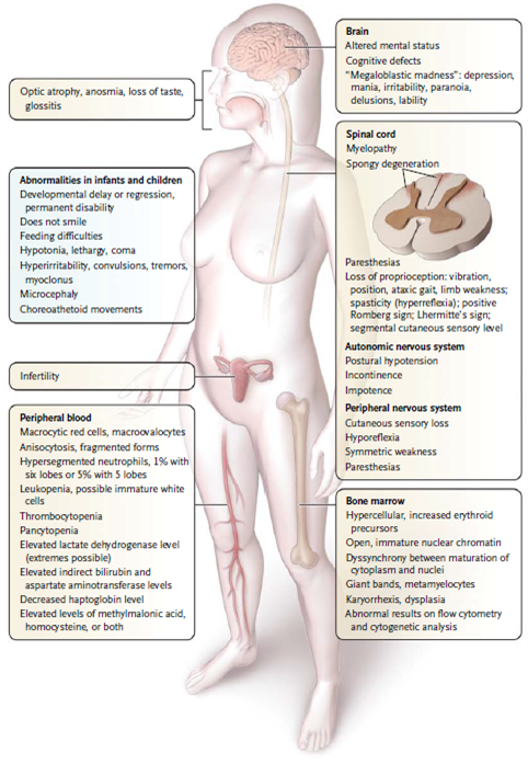 Complications and manifestation associated with Vitamin B12 deficiency.